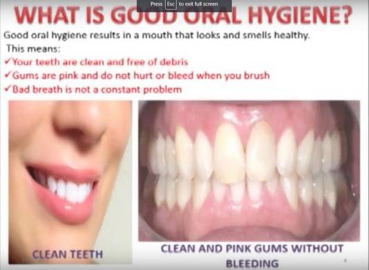 What is good oral hygiene?